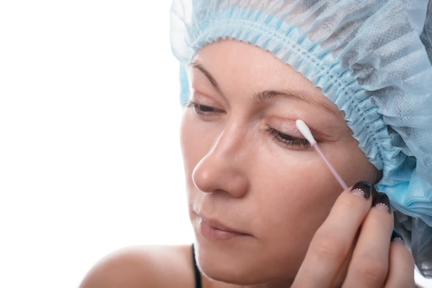 Blefaroplastia del párpado superior. Una operación que elimina el exceso de piel fea de los párpados por encima de los ojos. La imagen muestra cómo el paciente se ve después del párpado. La cicatriz se lubrica con