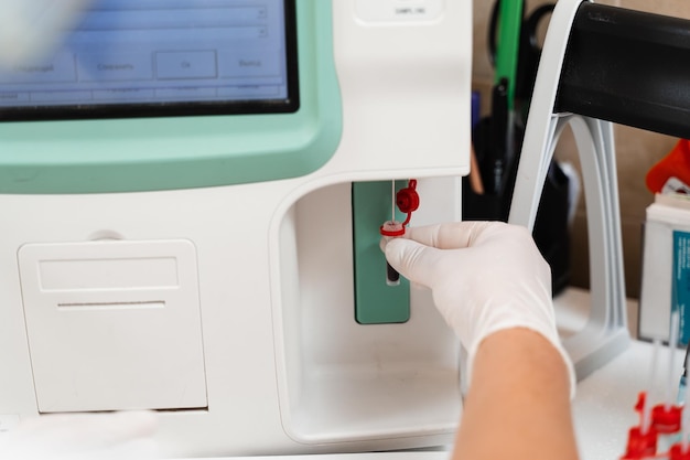 Blutanalyse auf Analysator im Labor Nahaufnahme Laborassistent macht hämatologische Analyse Medizinische Geräte im Labor Biochemische und hämatologische Analyse von Blut