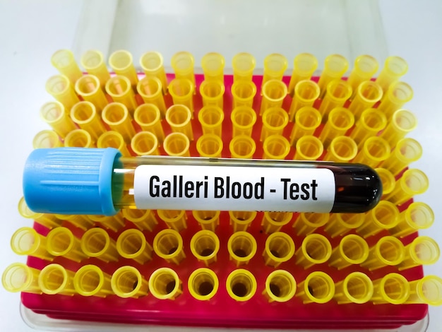 Blutentnahmeröhrchen für den Galleri Bluttest zur Früherkennung von Multikrebs.
