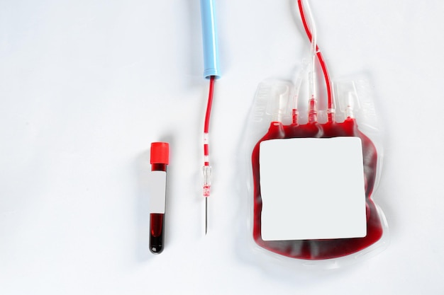Blutpackung für Transfusion und Reagenzglas auf weißem Hintergrund Draufsicht Spendentag