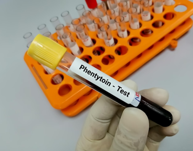 Blutprobe für biochemische Tests