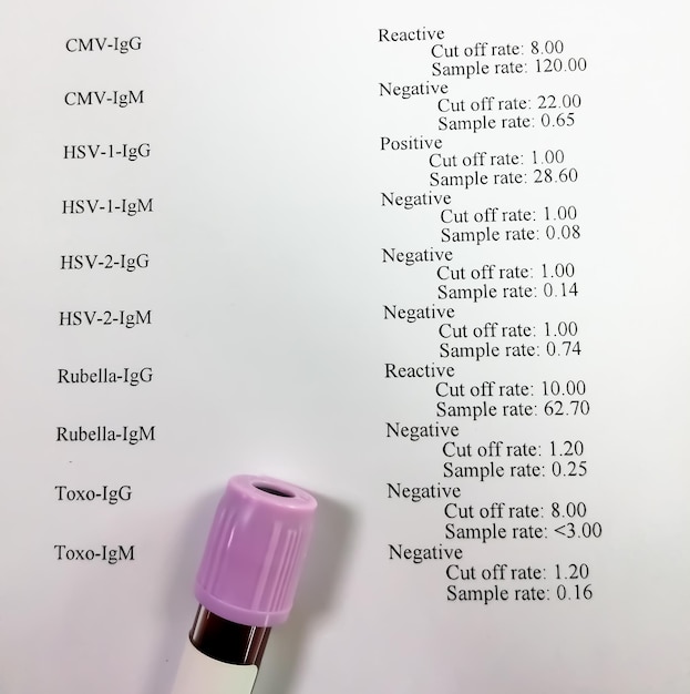 Blutprobe für TORCH-Test oder TORCH-Panel-Test einschließlich Toxoplasma Rubella CMV HSV mit Bericht