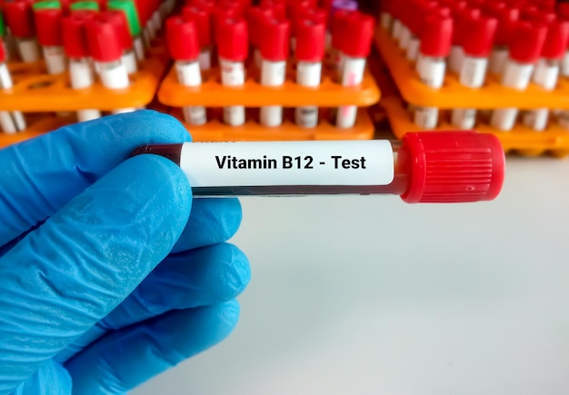 Blutprobe für vitamin b12- oder cobalamin-test