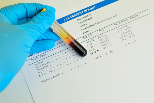 Foto blutprobe mit elektrolyt-testergebnis