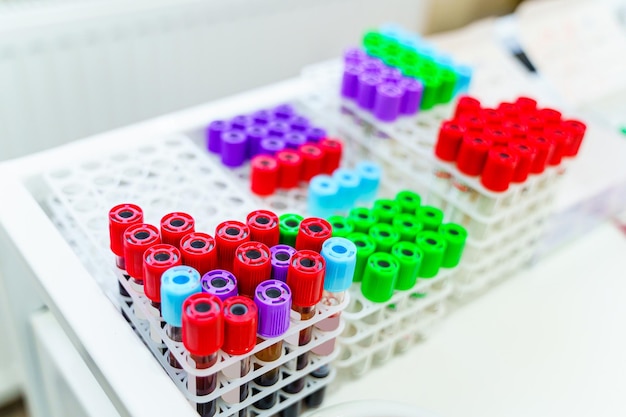 Blutproben für die forschung in mikroröhrchen tests im labor chemische forschung prävention lungenentzündung diagnose von covid19 und coronavirus-identifizierung pandemie