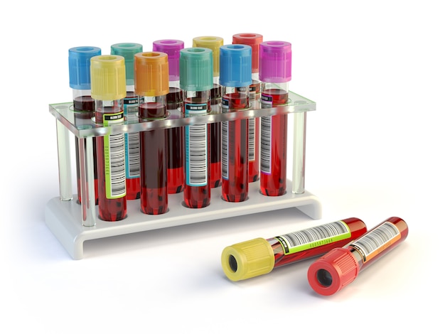 Blutteströhrchen. Blutproben in einem Rack, isoliert auf weiss. 3D-Darstellung