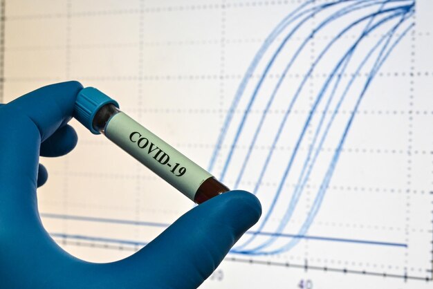 Blutuntersuchung auf das Coronavirus, das COVID19 verursacht