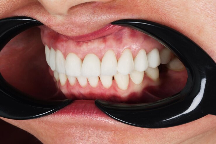 Boca abierta masculina caucásica que muestra una fila de dientes blancos y la parte posterior de la garganta Primer plano macro