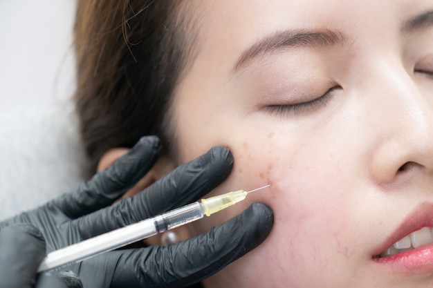 Botox, inyección de relleno para rostro femenino asiático. Cirugía estética estética plástica en clínica de belleza.