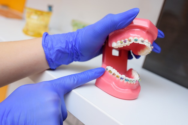 Brackets de colores en los dientes en un primer plano de mandíbula artificial