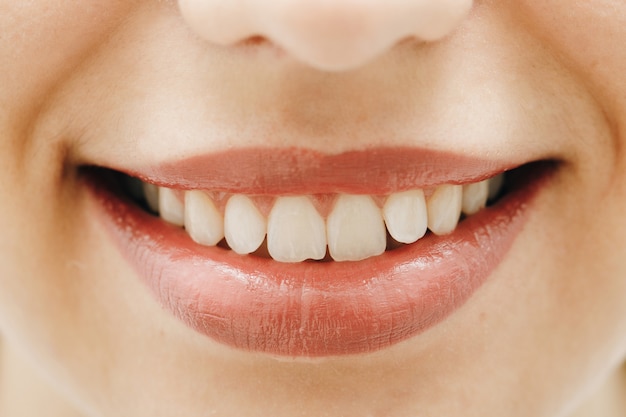 Breites Lächeln der jungen frischen Frau mit großen gesunden weißen Zähnen.