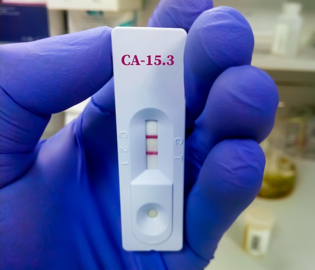 CA 15 3 Schnelltestgerät ein Tumormarker zur Brustkrebsdiagnostik