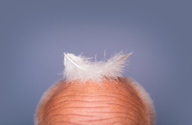 Foto cabeza de anciano calvo calvicie mayor masculina pérdida de cabello problemas de salud envejecimiento tratamiento del cabello y caída del cabello