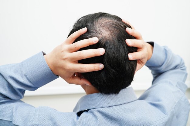 Cabeza calva en el hombre tratamiento de pérdida de cabello problema de salud