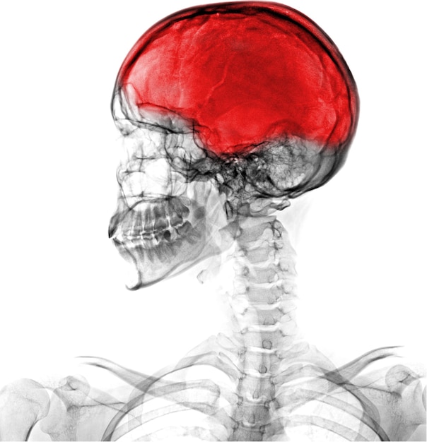 Una cabeza humana con un cerebro rojo en el medio.