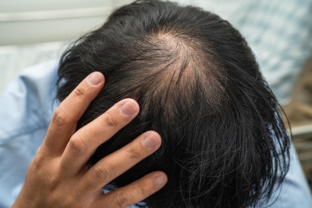 Calvo en la mitad de la cabeza y sin pérdida de cabello glabro de hombre de oficina activo inteligente de negocios asiáticos maduros