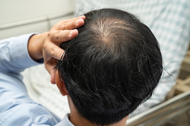 Calvo en la mitad de la cabeza y sin pérdida de cabello glabro de hombre de oficina activo inteligente de negocios asiáticos maduros