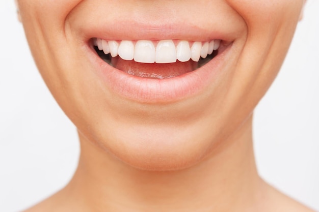 Captura recortada de una joven sonriente que demuestra dientes perfectos y blancos. Carillas, blanqueamiento dental