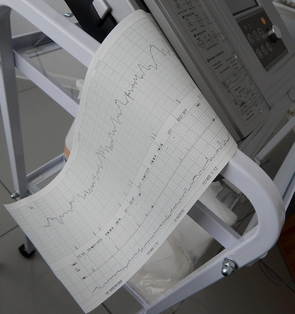 Cardiógrafo que imprime el gráfico de la frecuencia cardíaca humana