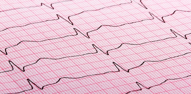 Cardiograma de batimento cardíaco em papel vermelho