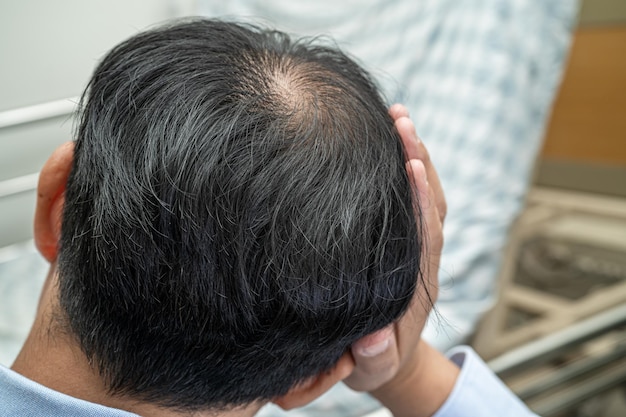 Careca na cabeça do meio e não começa a perder o cabelo glabro de um homem de escritório ativo inteligente de negócios asiáticos maduros