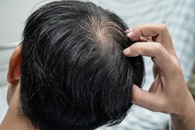 Careca na cabeça do meio e não começa a perder o cabelo glabro de um homem de escritório ativo inteligente de negócios asiáticos maduros