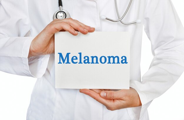 Cartão de melanoma nas mãos do médico