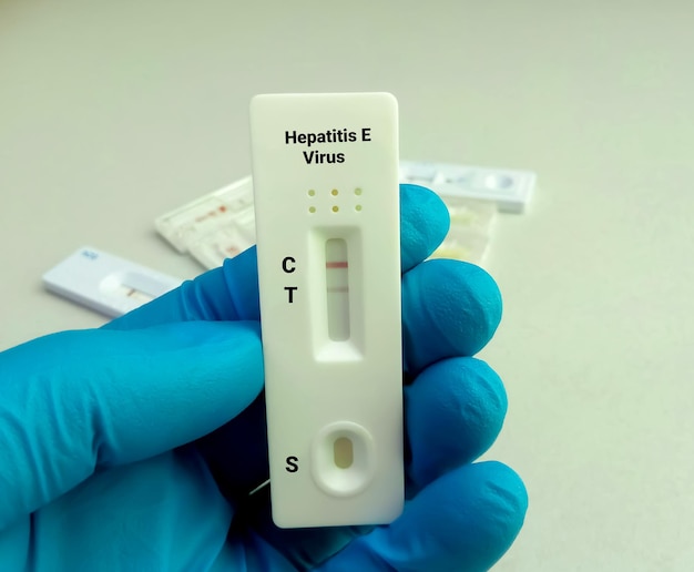 Casete de prueba rápida de hepatitis E