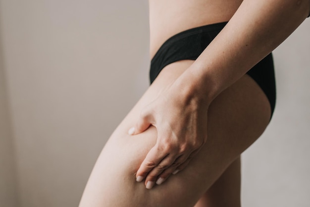 Cellulite auf der Haut aus nächster Nähe