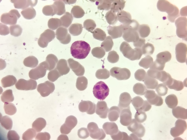 Célula de neutrófilo en frotis de sangre.