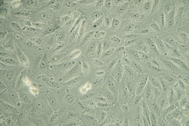 Células cancerosas humanas sob a textura de fundo do microscópio