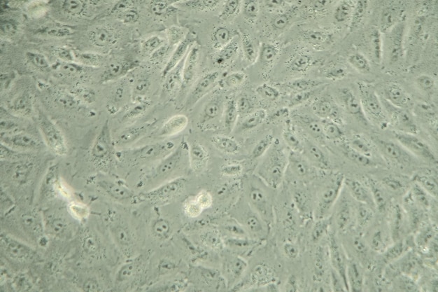 Células cancerosas humanas bajo la textura de fondo del microscopio