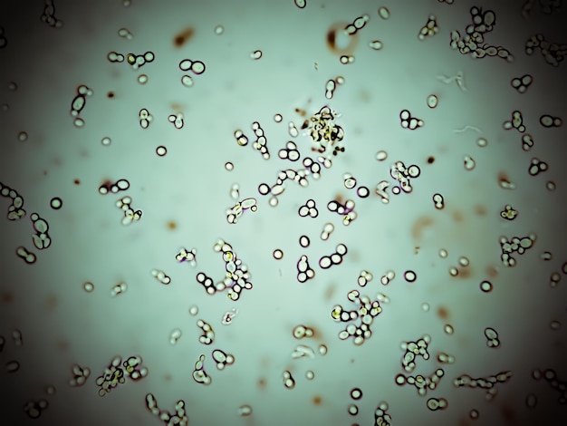 Foto células de levedura em brotamento na análise de infecções do trato urinário de pacientes com pielonefrite ou cistite