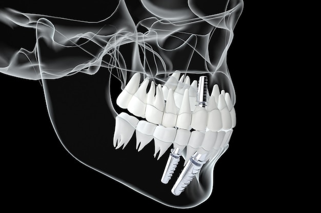 Cena Restauração Dentária