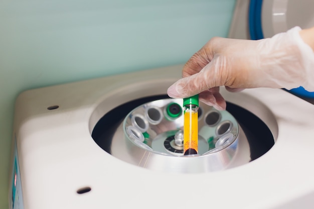 Centrífuga de laboratório médico com tubos de ensaio com sangue.