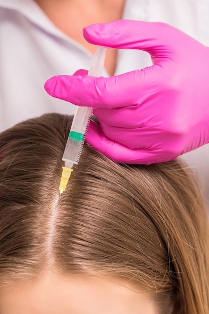 Cerca del doctor cosmetólogo haciendo inyecciones de mesoterapia en la cabeza de la mujer. Concepto de mesoterapia.