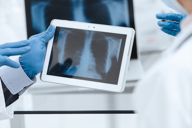 De cerca. Radiografía de los pulmones en la pantalla de una tableta digital.