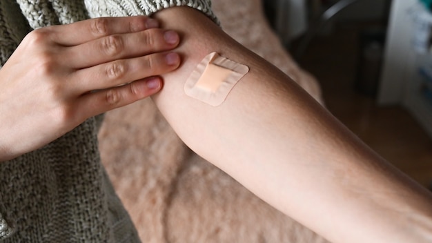 Cerca de yeso en el brazo después de donar sangre