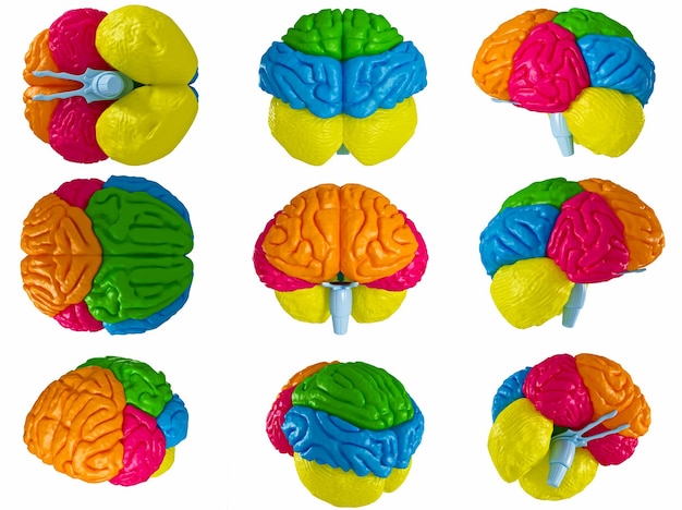 Cerebro modelo 3D en diferentes proyecciones