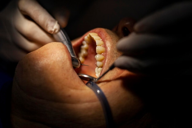 Cerrar examen y tratamiento dental limpieza dental instrumento dental higiene dental
