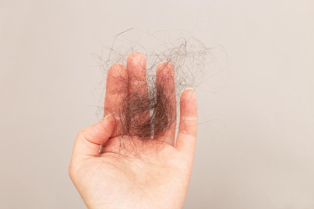 Cerrar foto de mano femenina sosteniendo el cabello perdido en la mano sobre un fondo beige