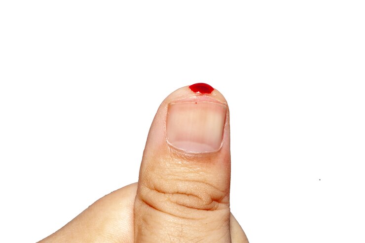 Cerrar sangre en el pulgar en blanco