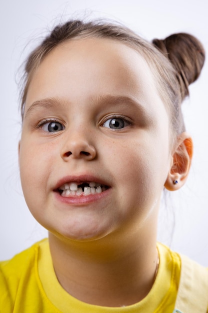 Charmantes kleines weibliches Kindergesicht mit geöffnetem Mund, das den fehlenden Milchzahn vorne in gelbem T-Shirt auf weißem Hintergrund zeigt. Erste Zähne wechseln Zum Zahnarzt gehen, um eine Zahnbehandlung durchzuführen