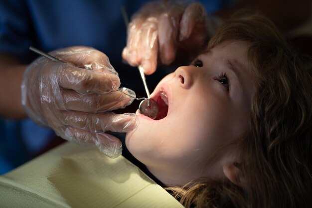 Chequeo de dientes en los dentistas que examinan los dientes de cerca Dentista que examina los dientes de los niños en la silla de los dentistas Procedimiento del dentista de los dientes de los niños