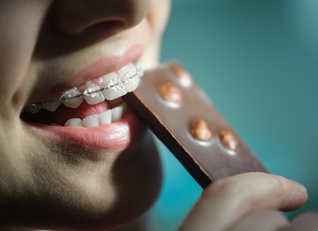 Chica comiendo chocolate, con dientes cerámicos.