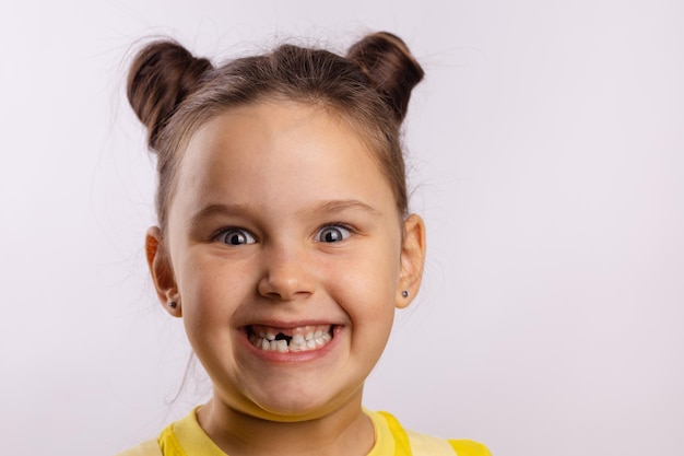 Chica joven sobreexcitada sonriendo con dientes con dientes de leche delanteros faltantes mirando la cámara sobre fondo blanco Los primeros dientes cambian yendo al dentista para hacer el tratamiento dental