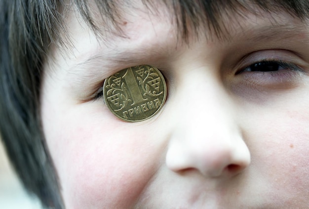 Chico divertido con la moneda ucraniana en el ojo