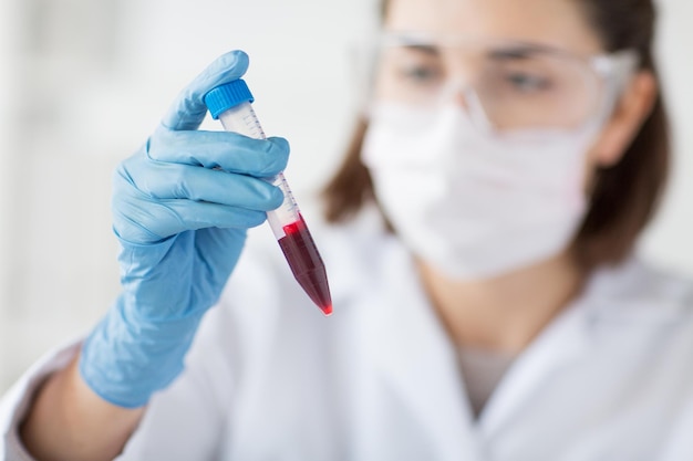 ciência, química, biologia, medicina e conceito de pessoas - close-up de jovem cientista feminina segurando tubo com fabricação de amostras de sangue e teste ou pesquisa em laboratório clínico