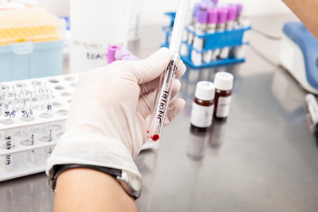 Foto científico preparando muestras de médula ósea para el análisis citométrico de flujo en el laboratorio