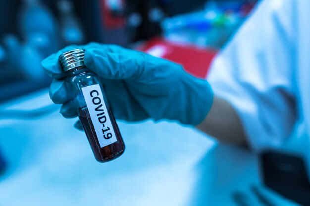 Científico que sostiene un tubo de ensayo con una muestra de sangre para la prueba COVID19 Se encontró un experimento para detectar el virus en la sangre